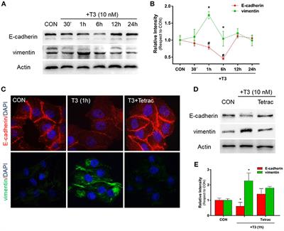 Molecular Actions of Thyroid Hormone on Breast Cancer Cell Migration and Invasion via Cortactin/N-WASP